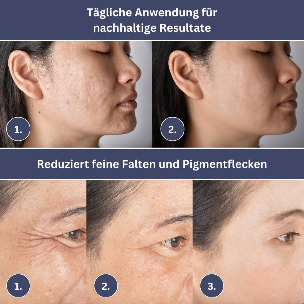 LED-Lichttherapie-Maske DermaBright