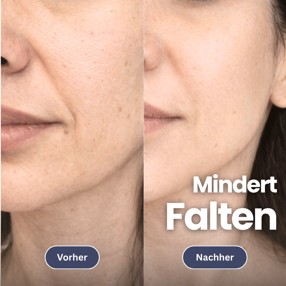 Microneedling infusieset voor een stevigere huid