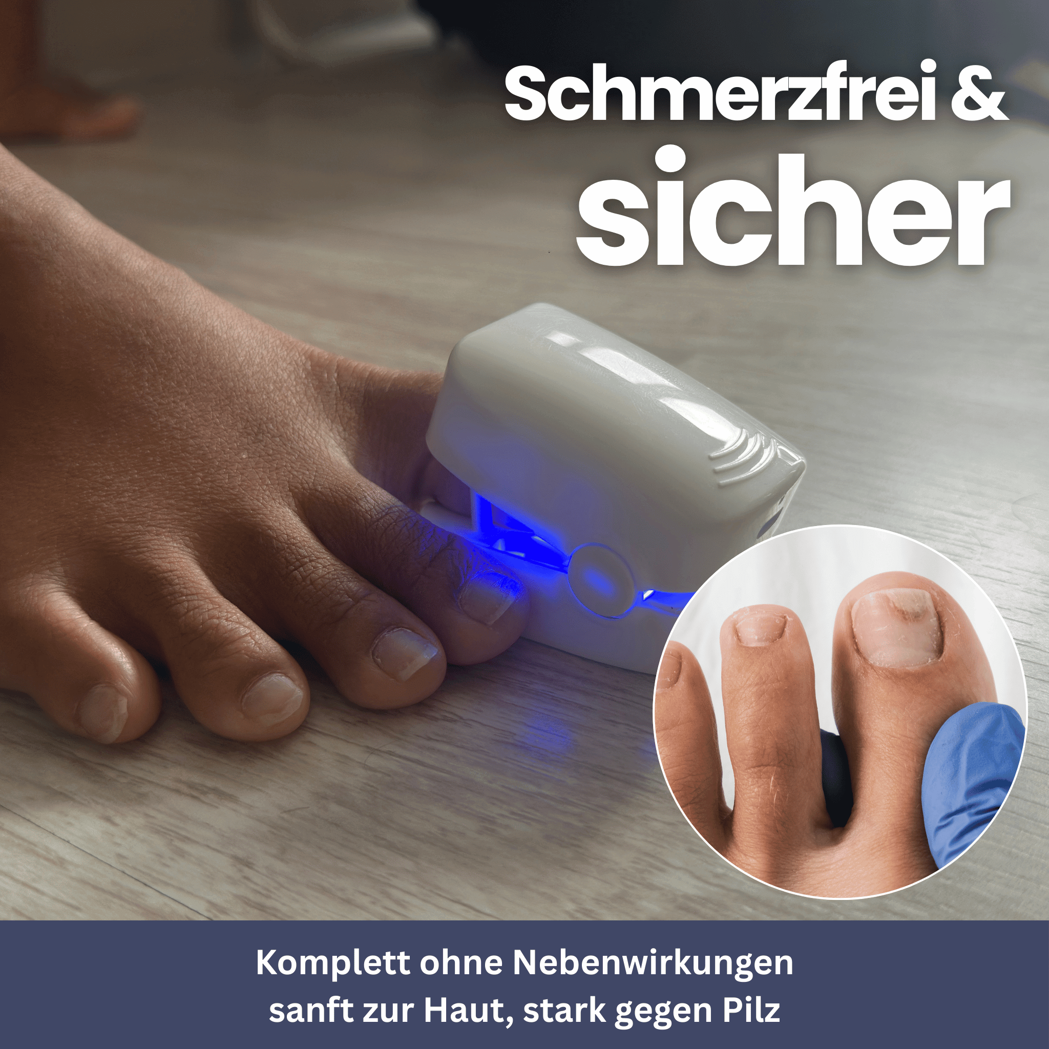 NailClip – Schimmelnageltherapieapparaat