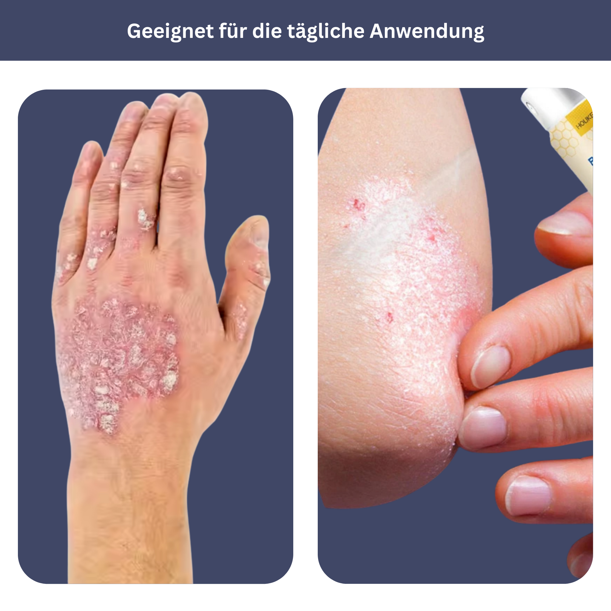 HOUKEA Bijengif Kalmerende Spray