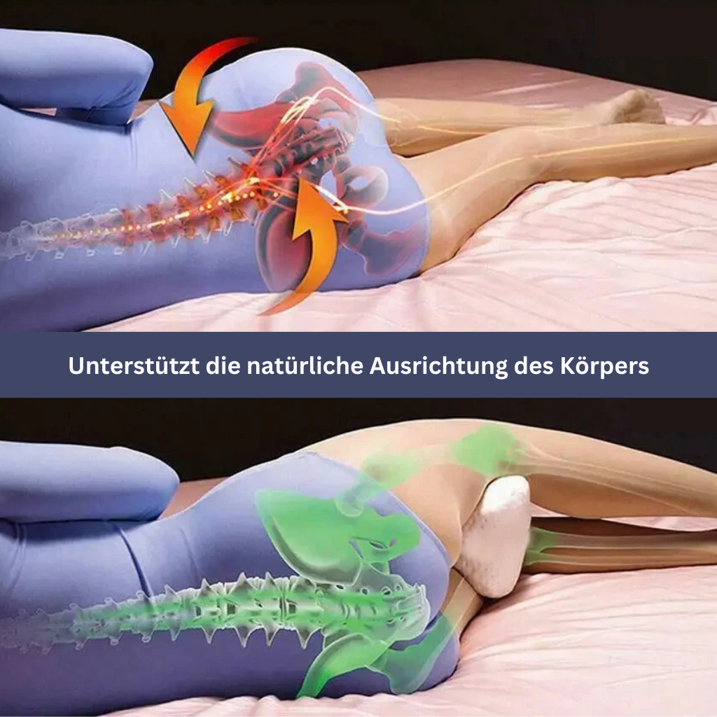 DreamSleep – Ergonomisch knie- en beenrustkussen