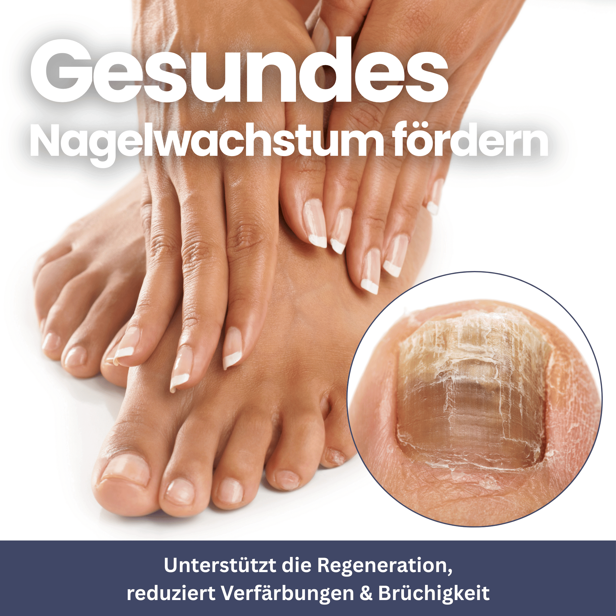NailClip – Schimmelnageltherapieapparaat