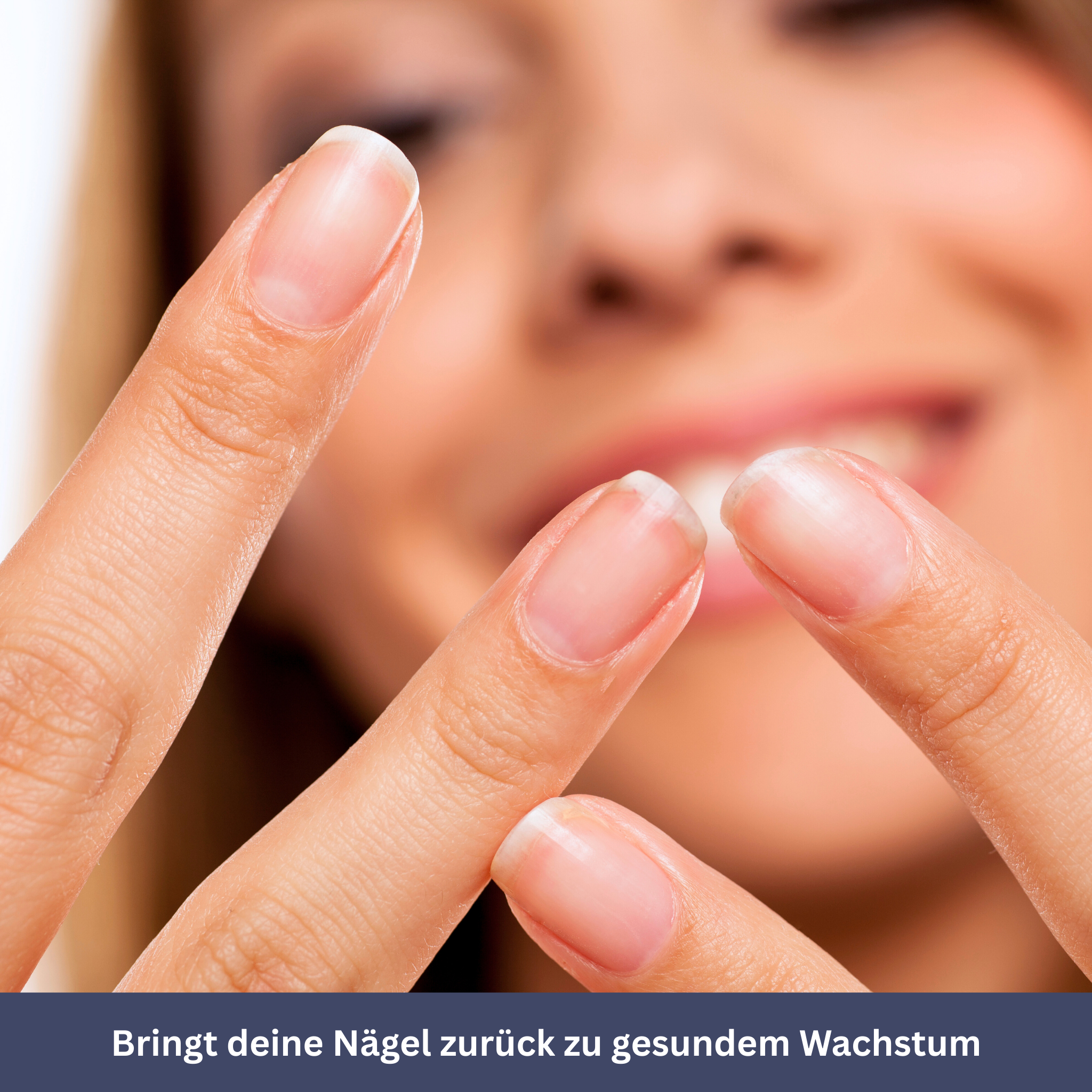 NailDrops – Verzorgend serum tegen schimmelnagels