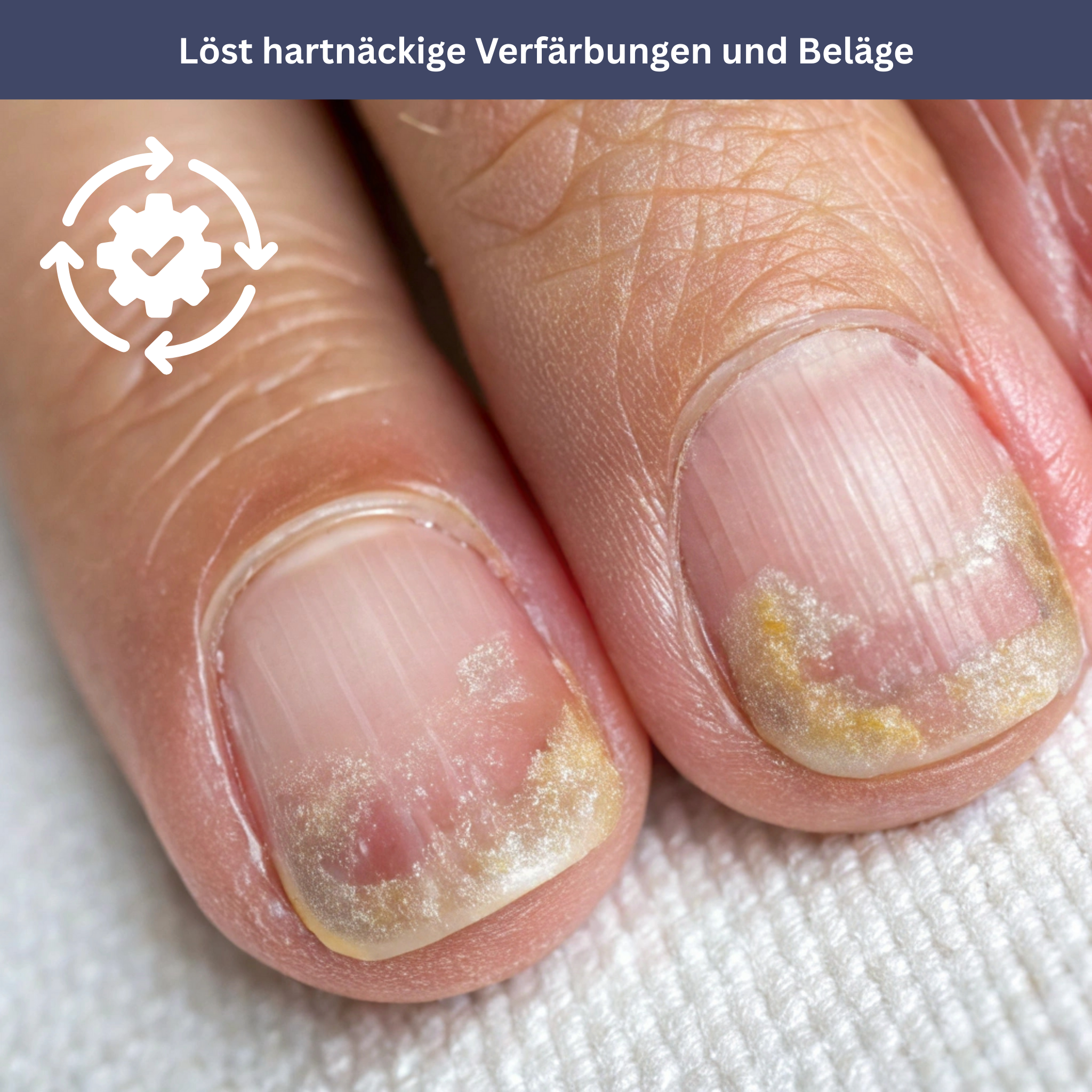 NailDrops – Verzorgend serum tegen schimmelnagels