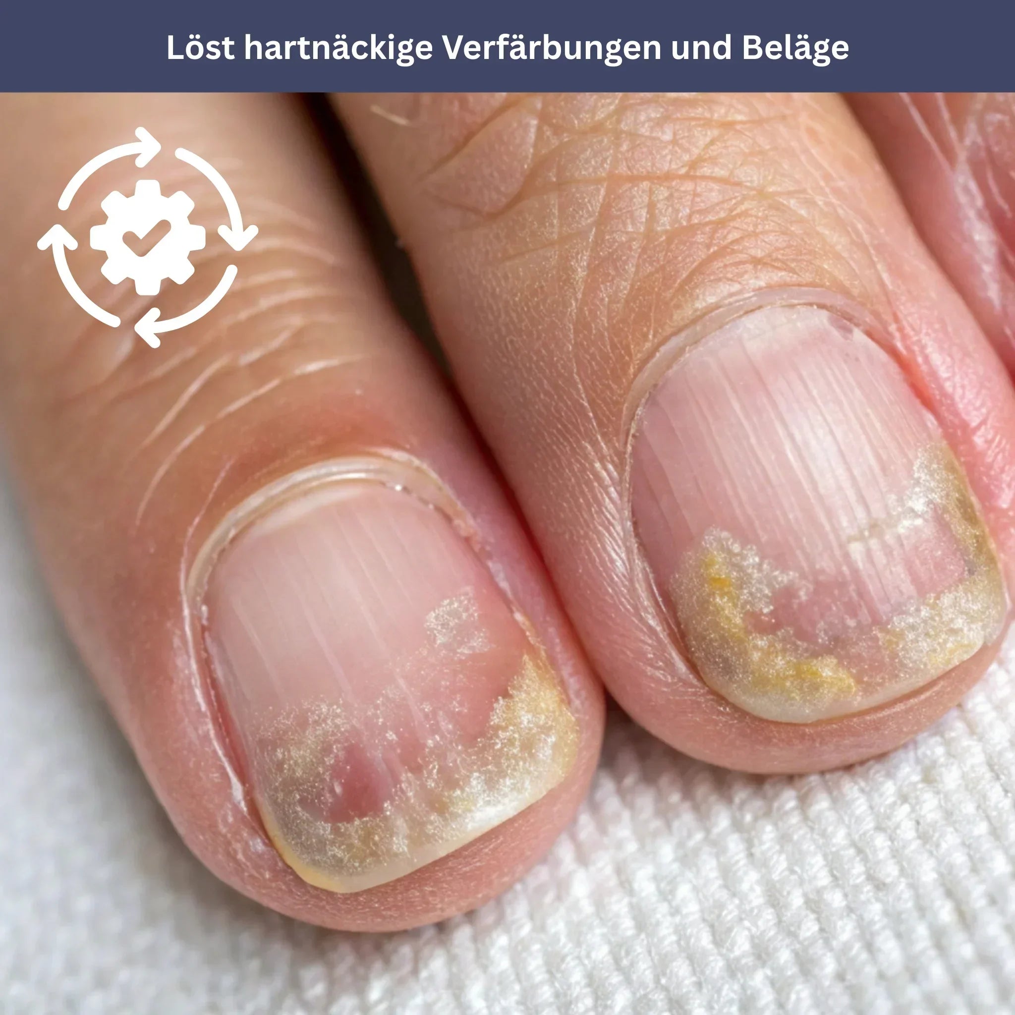 NailDrops – Verzorgend Serum tegen Schimmelnagels