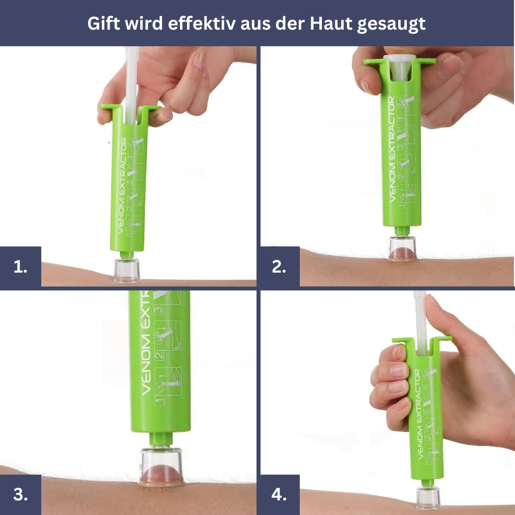 Anti-insecten bundel – steekverlichter, gifzuiger, muggenarmband