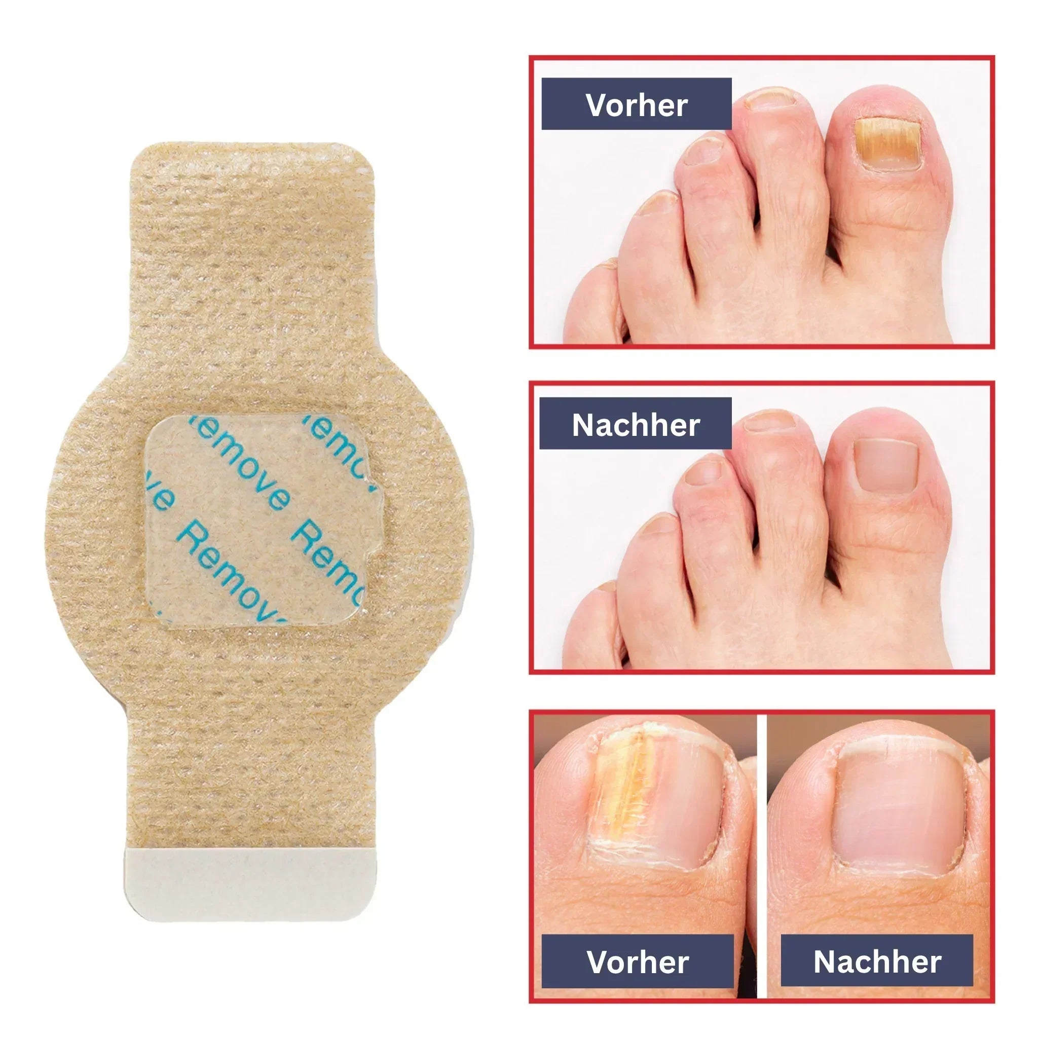 Nagelverzorging Hydrogel Patches