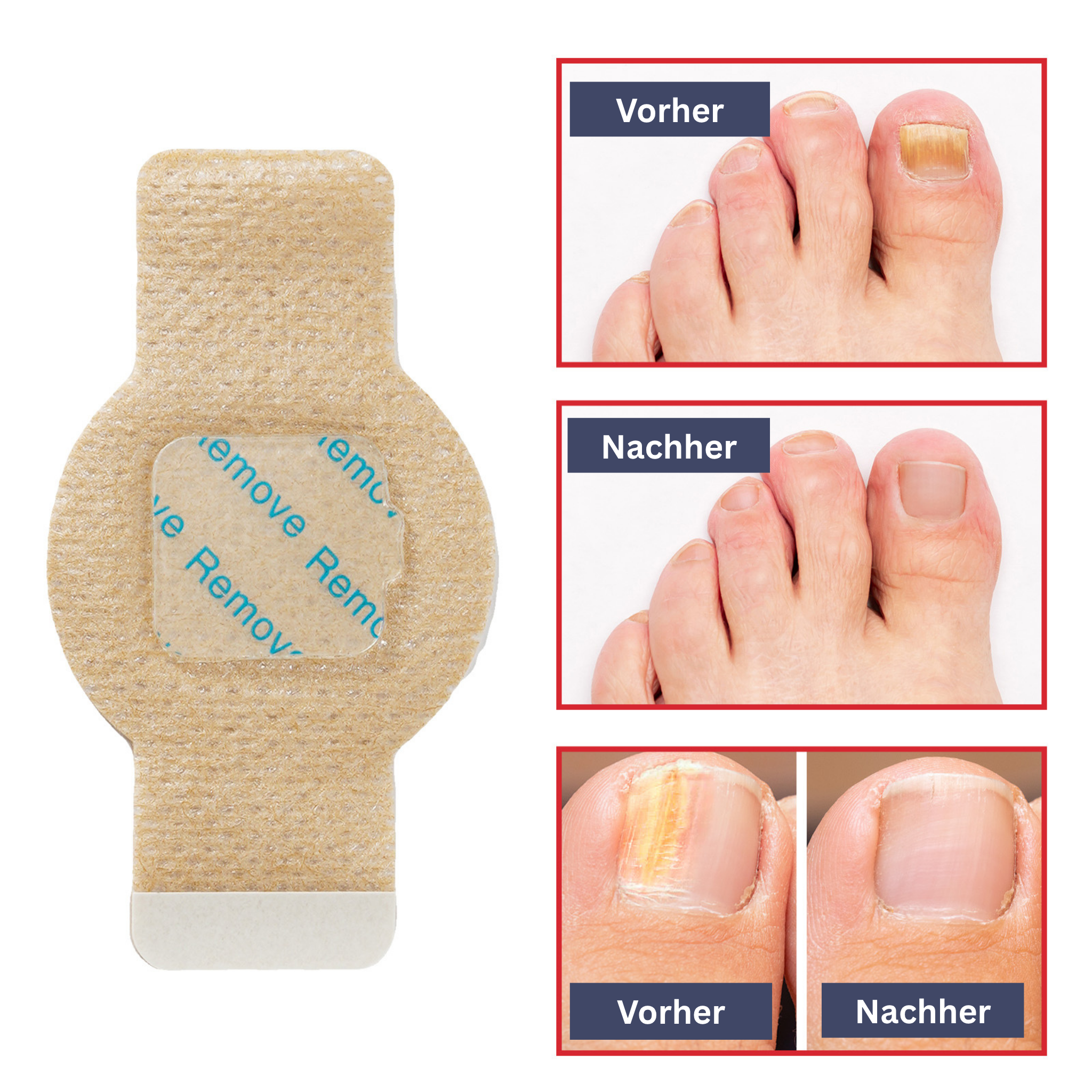 Nagelverzorging Hydrogel Patches