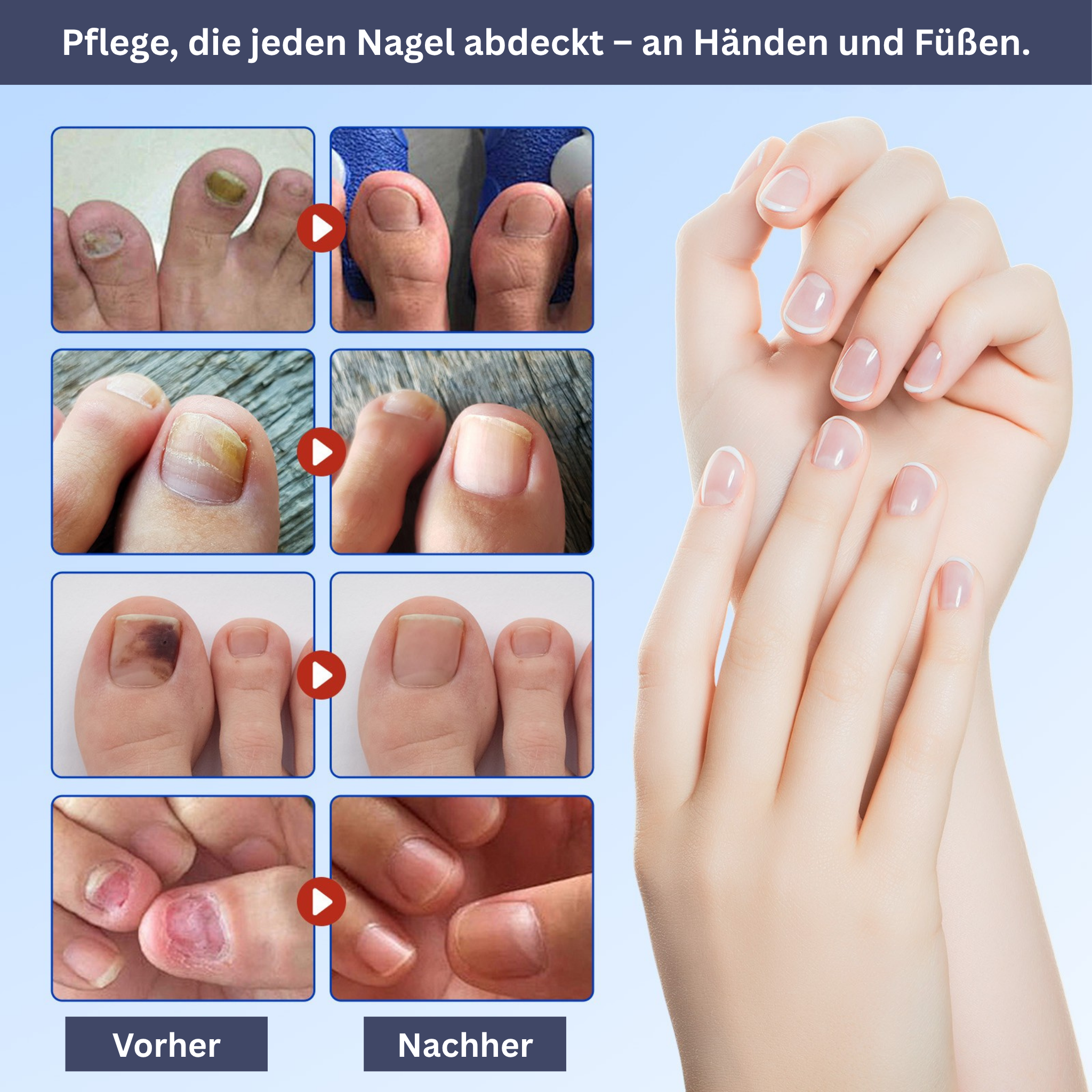 Nagelverzorging Hydrogel Patches
