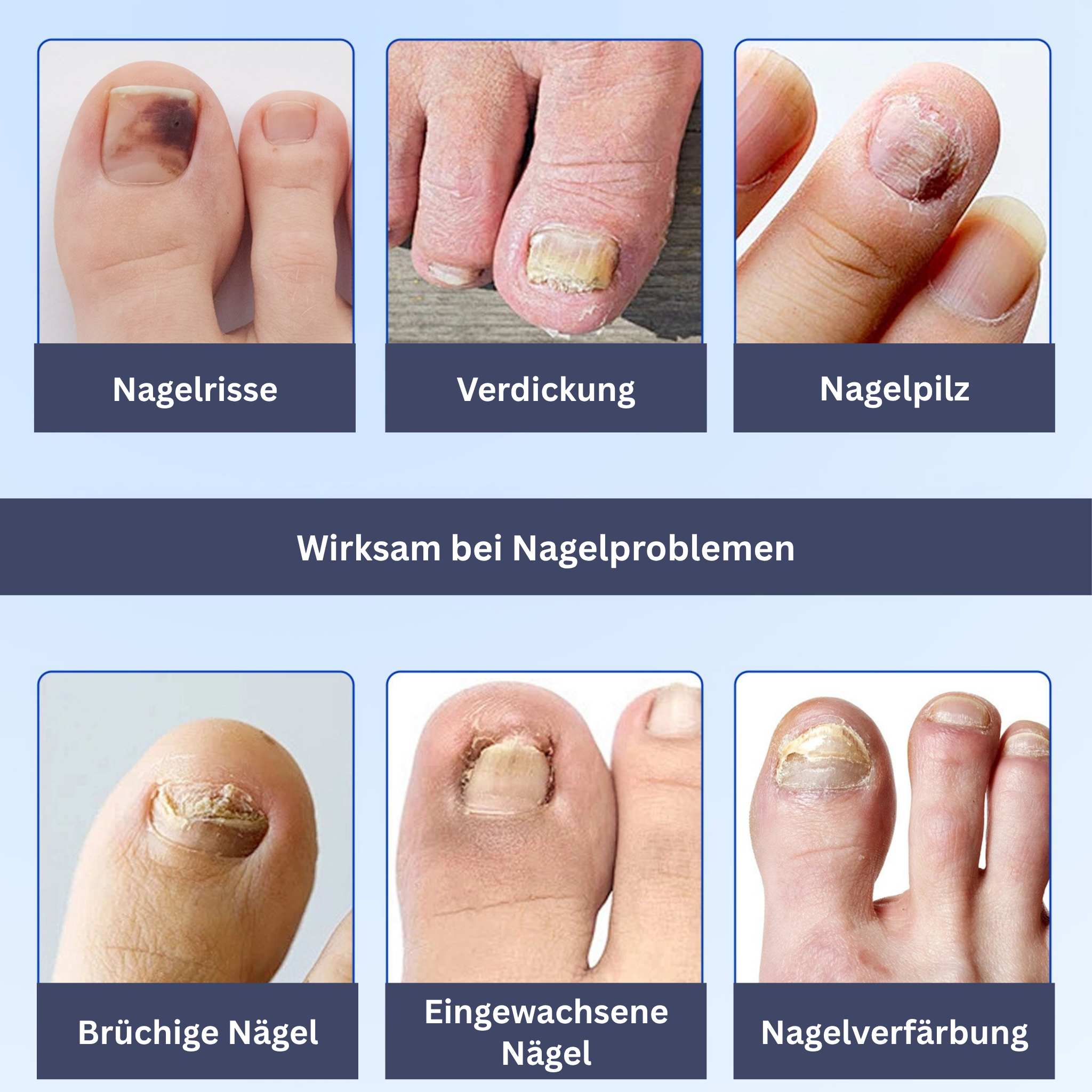 Nagelverzorging Hydrogel Patches
