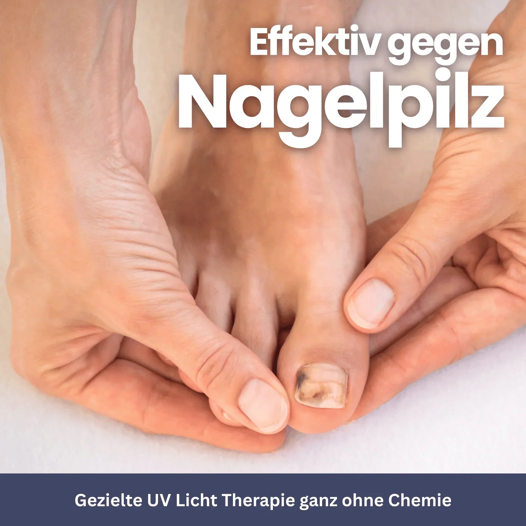 NailCare – Schimmelnageltherapie met UV-licht