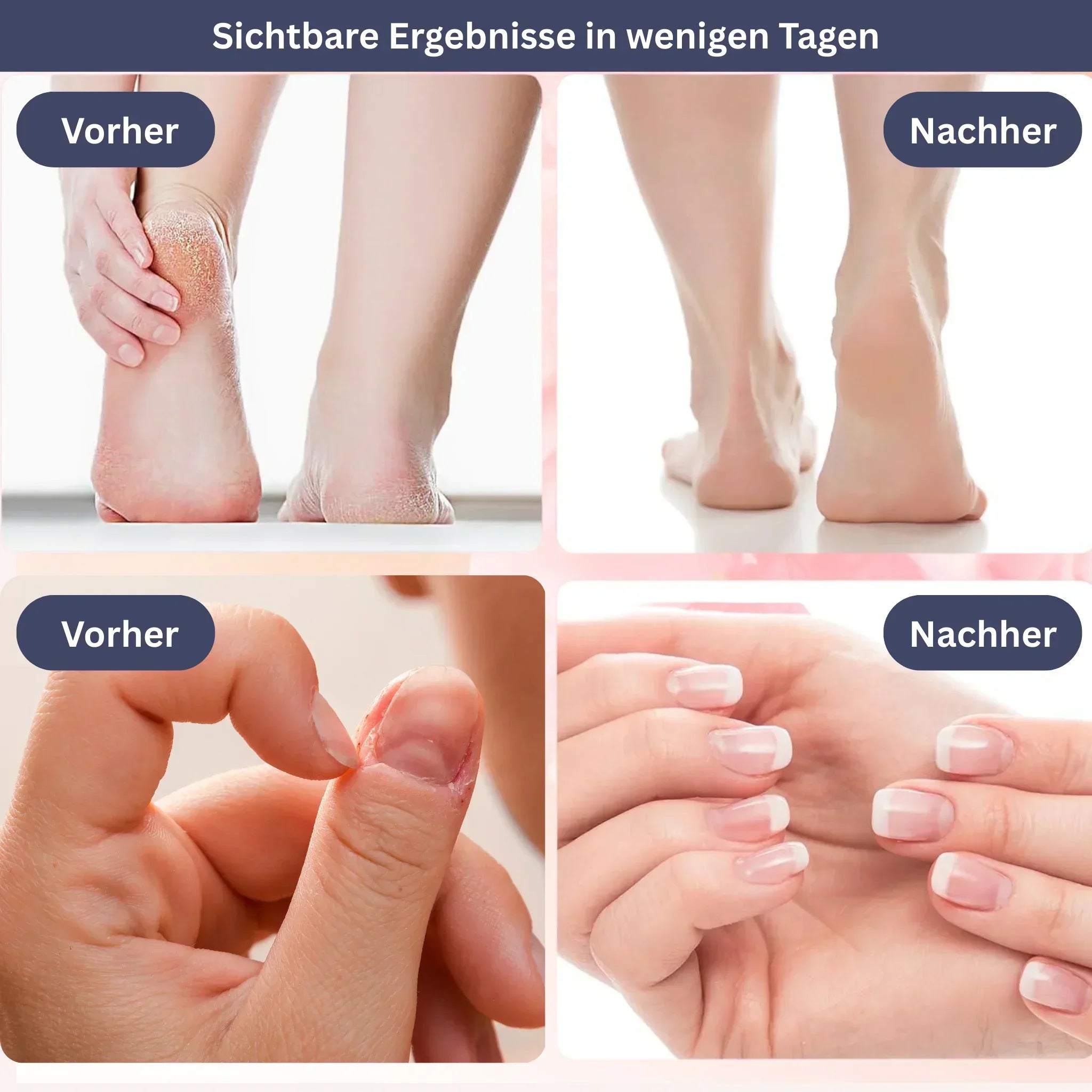 SamtFuß Pro – Elektrische Eeltverwijderaar