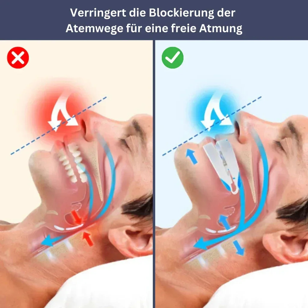 Schnarchschutz-Mundstück