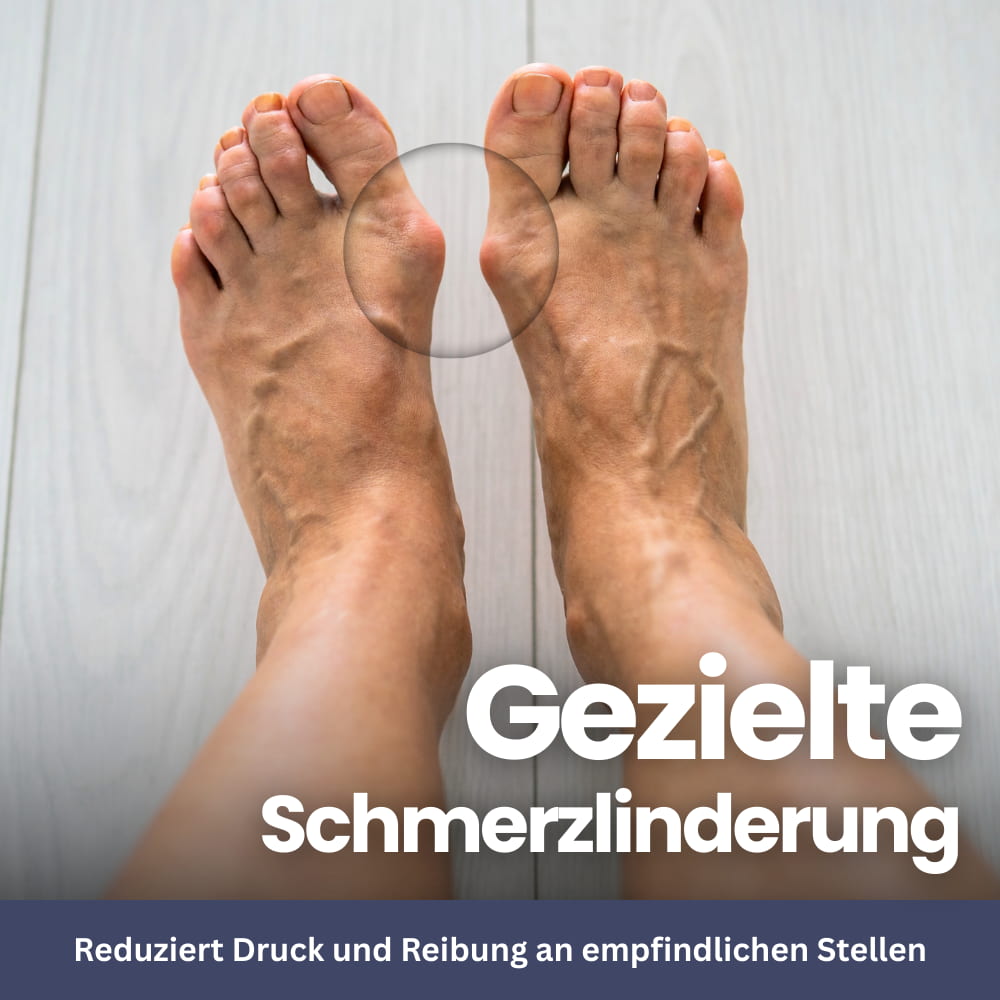 SoftAlign – Zehenschutz & Bunion-Korrektor