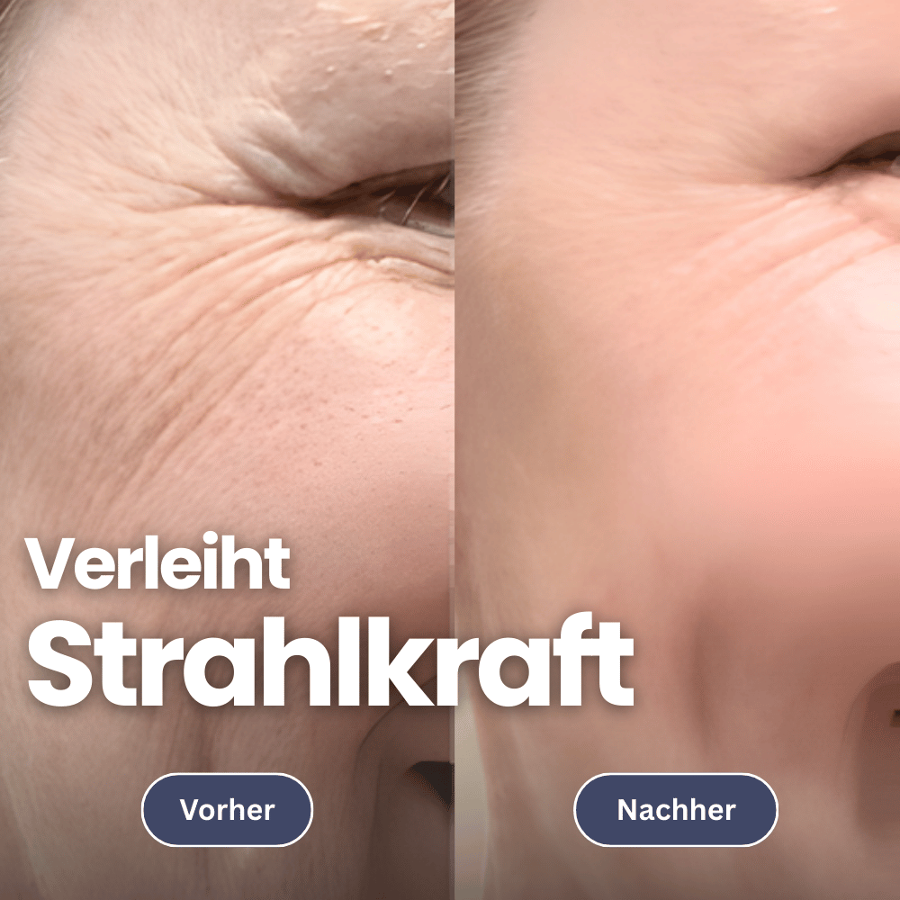 Microneedling infusieset voor een stevigere huid