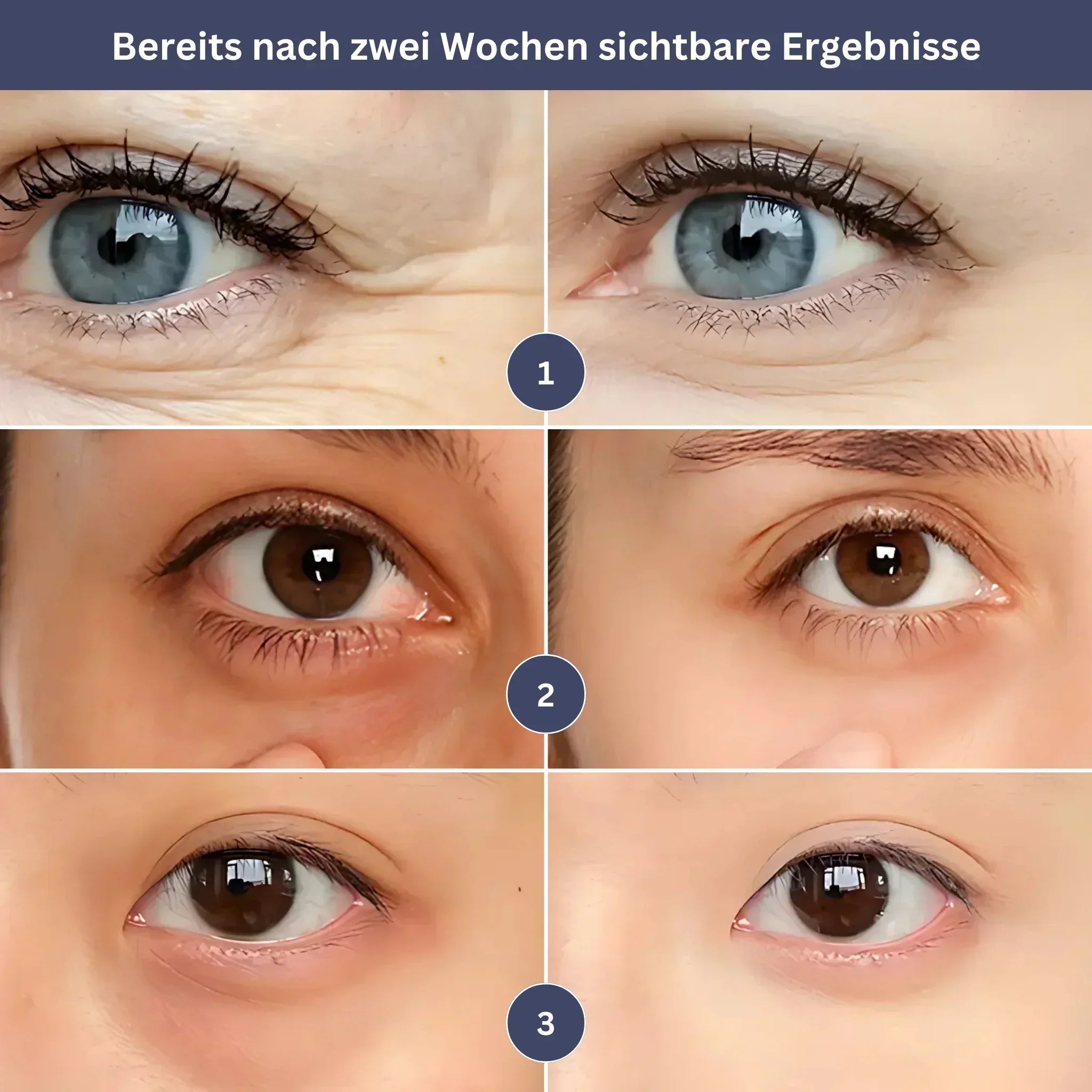 GlowEye – Jouw Verjongingsbooster voor Stralende Ogen