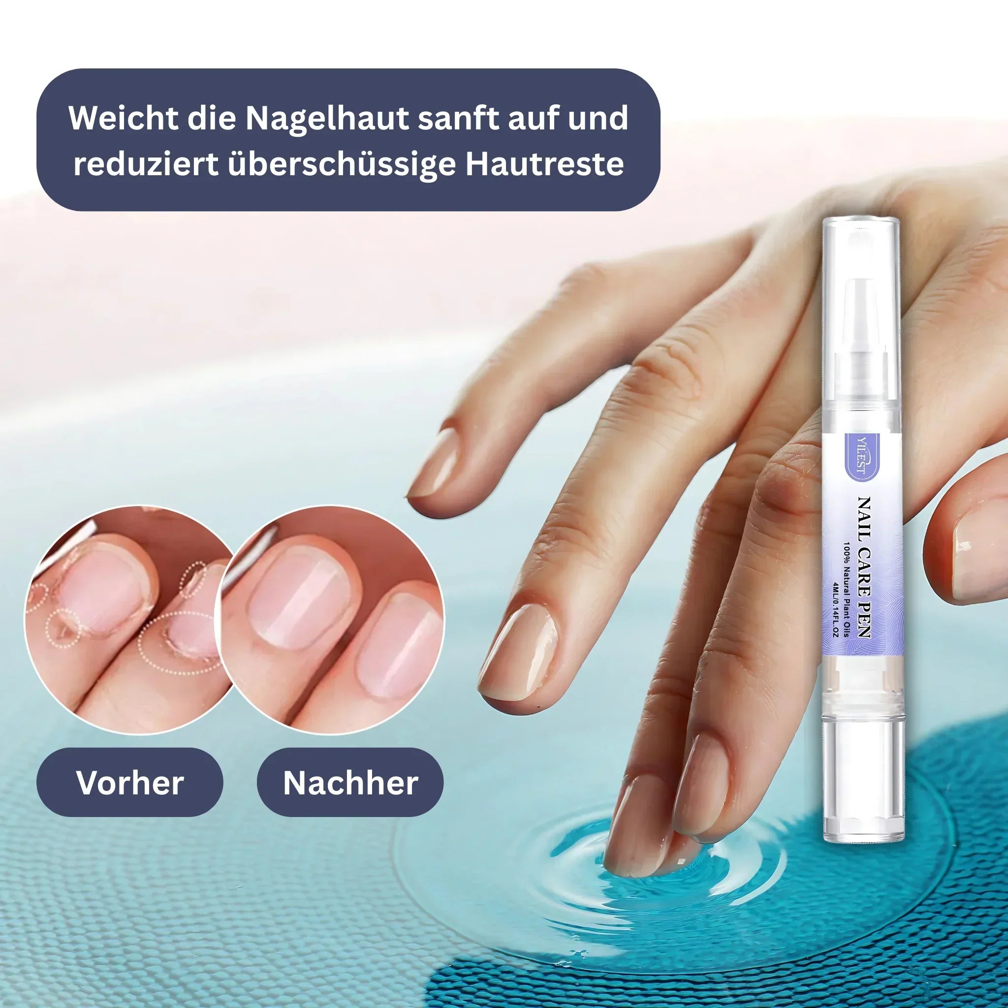 YILEST Natürlicher Nagelpflege-Stift